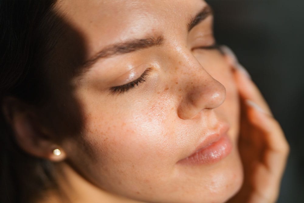 Sun shines on a woman's face after her microneedling treatment in Boynton Beach.
